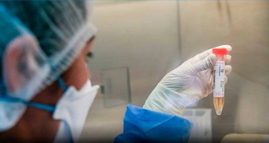 Coronavirus en Perú: 3168 nuevos casos y 100 fallecidos en las últimas 24 horas